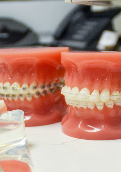 Dental Braces Long Beach CA