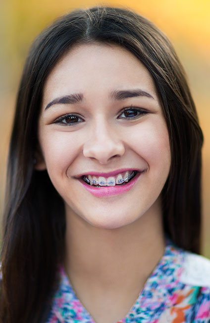 Traditional Metal Braces Long Beach CA