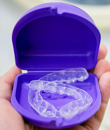 Retainers Long Beach CA