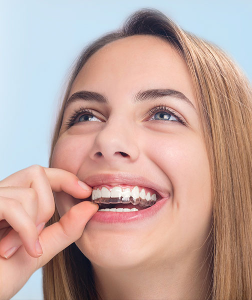 Invisalign Long Beach CA