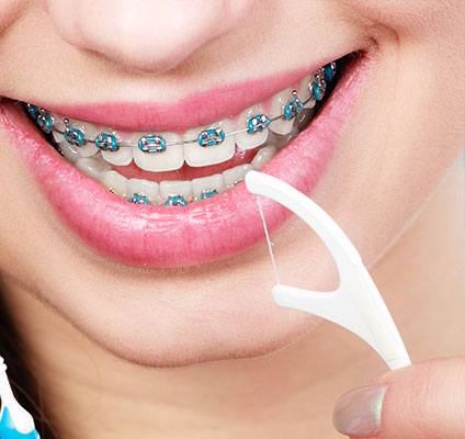 Metal Braces Bixby Knolls CA