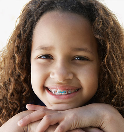 Porcelain Ceramic Braces Long Beach CA